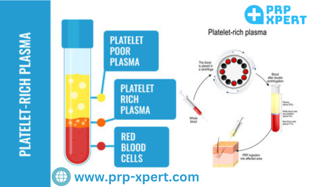 The Ultimate Guide to Help You How Long Does PRP Take to Work